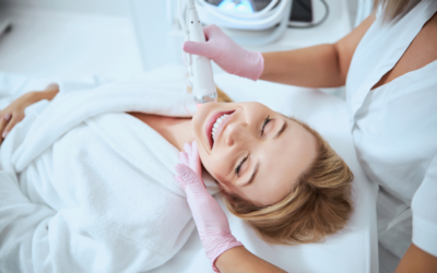Microneedling