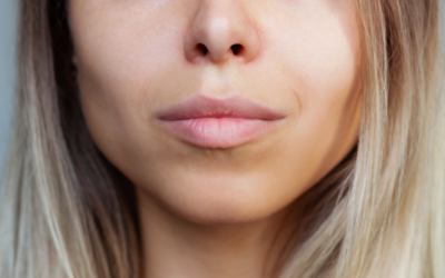 Λιπεκτομή Παρειών – Buccal Fat Removal